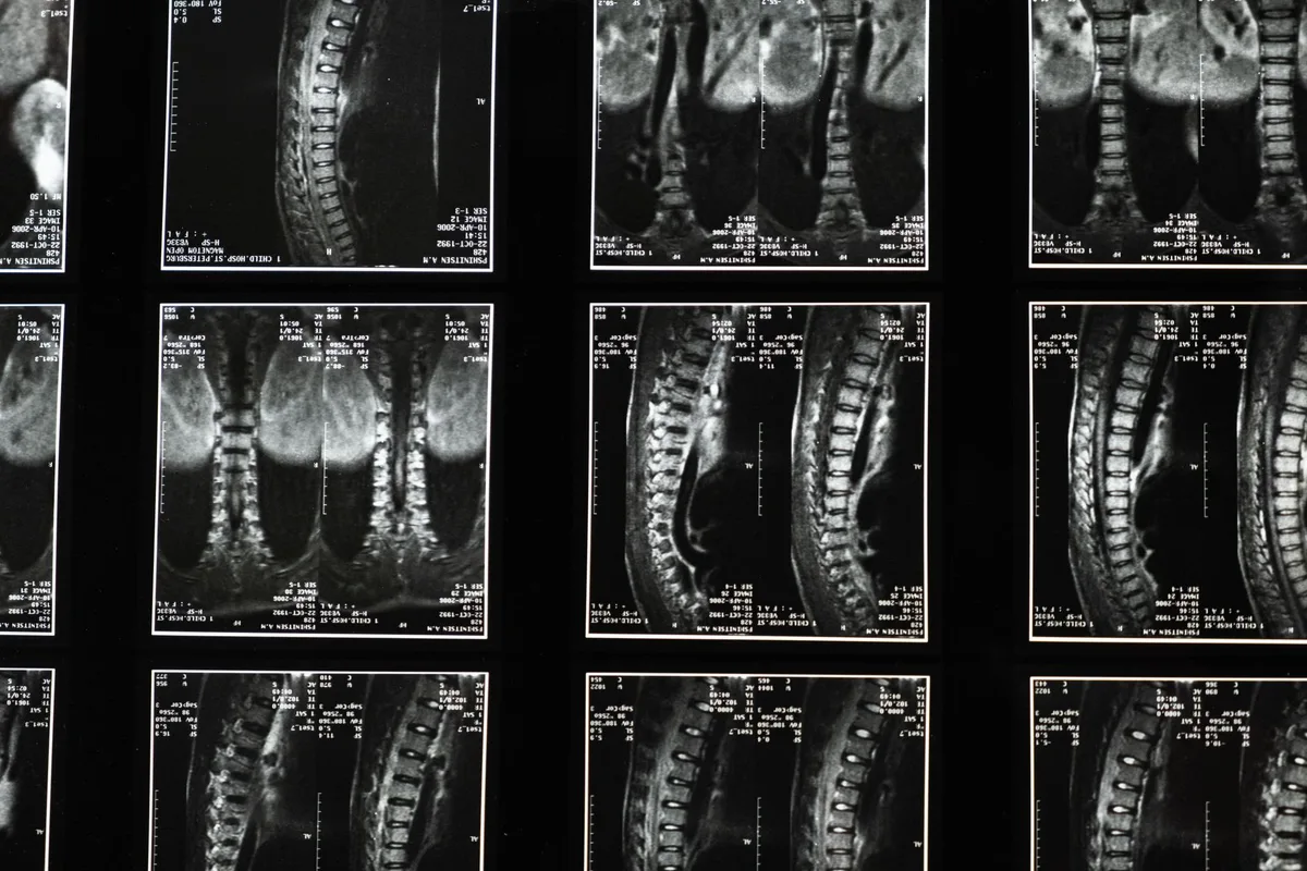 Schéma anatomique montrant la structure du cou et du cerveau