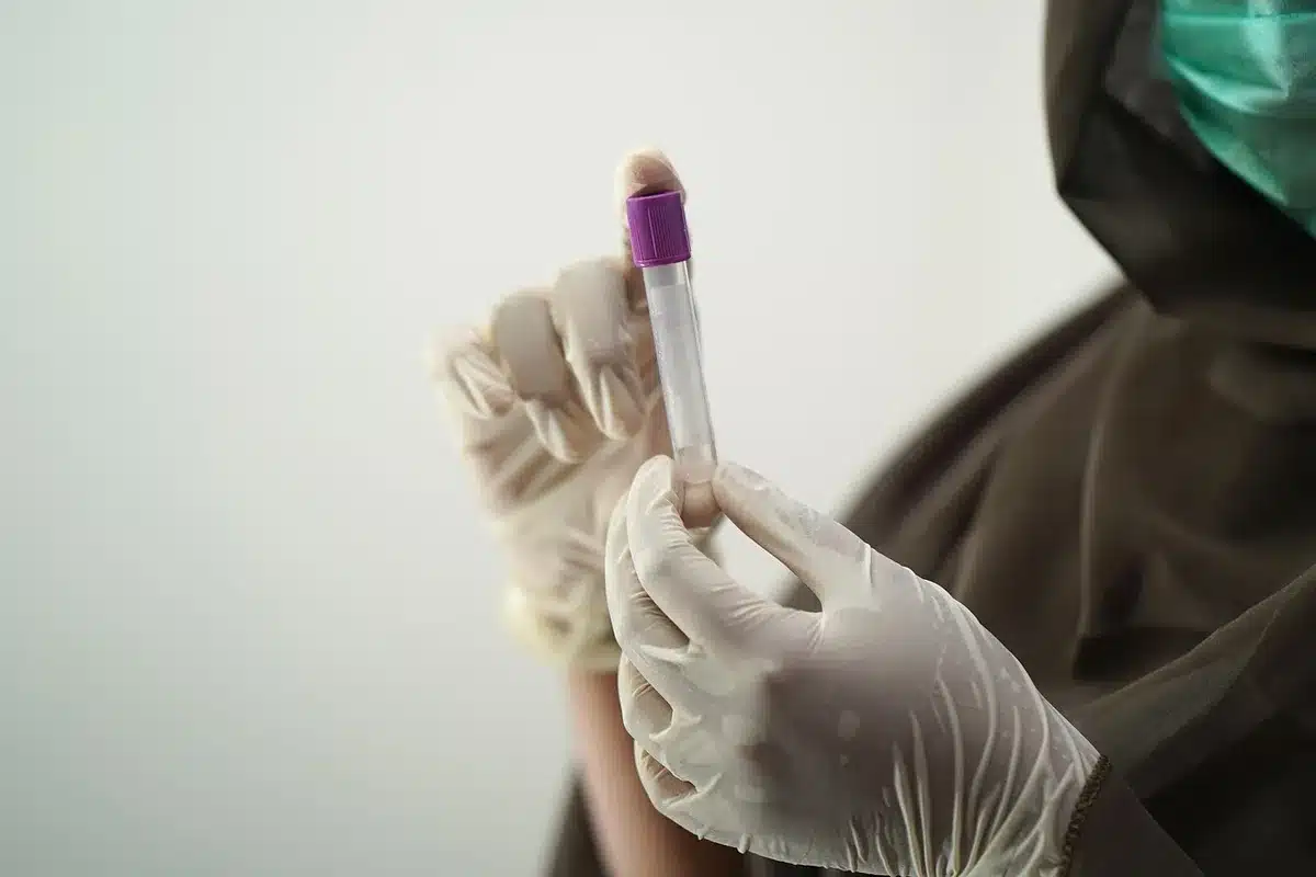 Tube de prélèvement sanguin en laboratoire étiqueté, illustration du marqueur GlycA