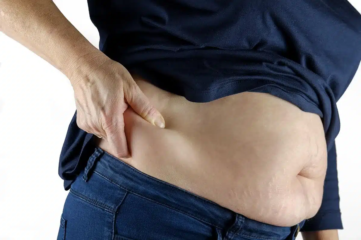Mesure de la composition corporelle montrant graisse abdominale