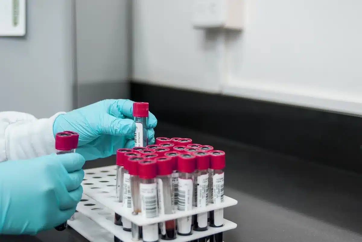 Appareil de mesure de composition corporelle dans un laboratoire, éclairé par la journée
