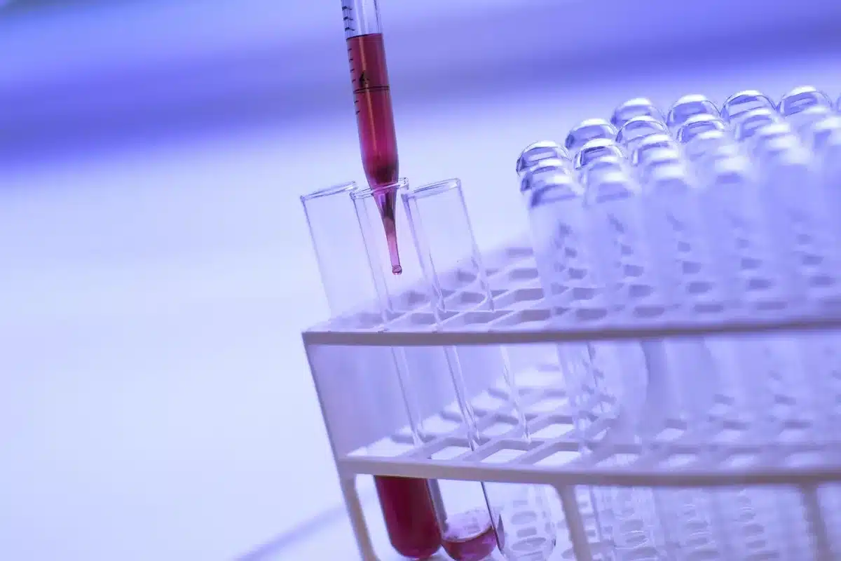 Graphique simplifié montrant baisse du LDL après supplémentation